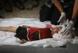 İşgalci İsrail’in Gazze Şeridi’nin Çeşitli Bölgelerini Bombalamasında 9 Şehit Ve Onlarca Yaralı